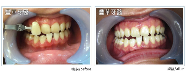 case 001 L case 001