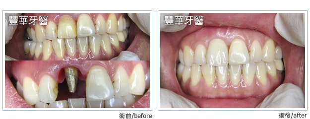 case 002 L case 002