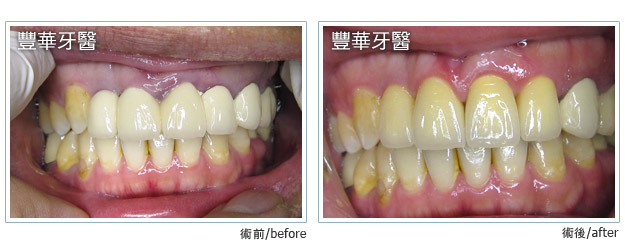 case 003 L case 003