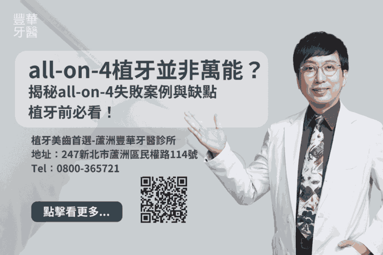 all-on-4植牙並非萬能?揭秘all-on-4失敗案例與缺點,植牙前必看! 6 all-on-4植牙並非萬能?揭秘all-on-4失敗案例與缺點,植牙前必看!