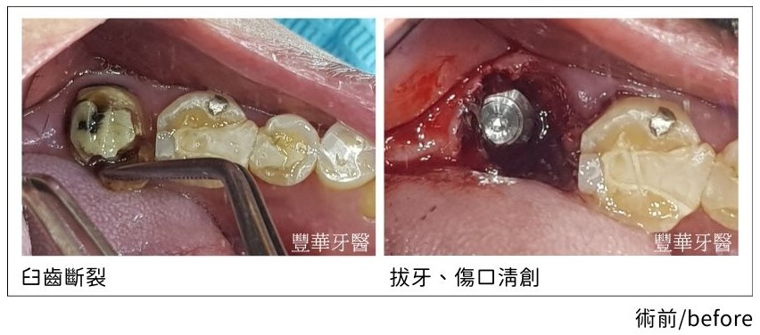豐華案例照