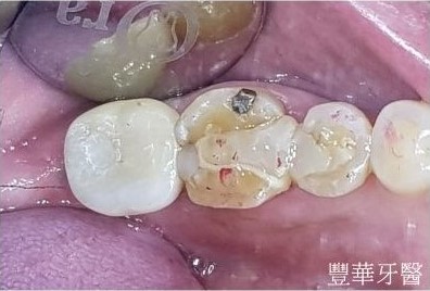 豐華內文圖