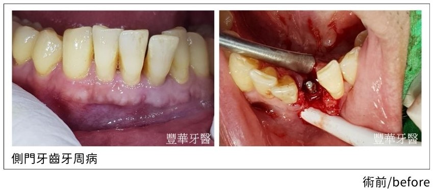 periodontal disease.01